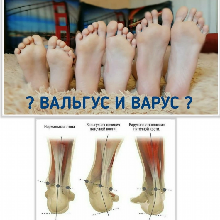 Массажистки иваново частные объявления